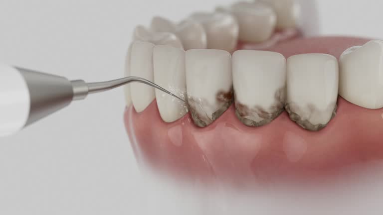 Reliable Dental Implants contractor in Hooper, UT by Smile Center Dentistry